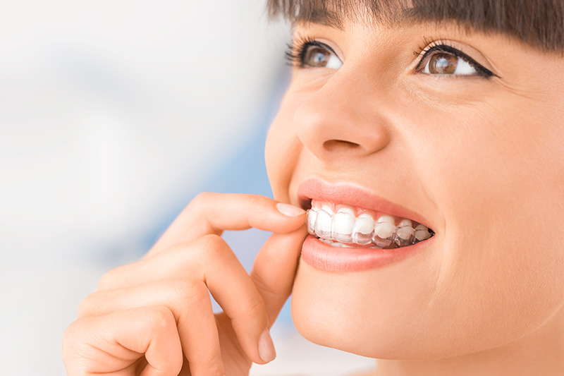 Invisalign in  Huntington Beach